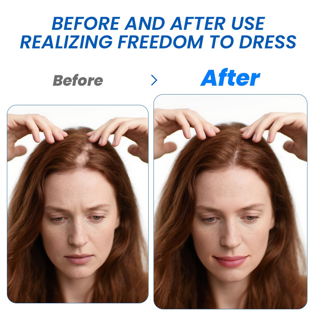 Alopesi Saç Çıkarma Spreyi Sop - Hair Care Cream incelemesi ve fiyatı