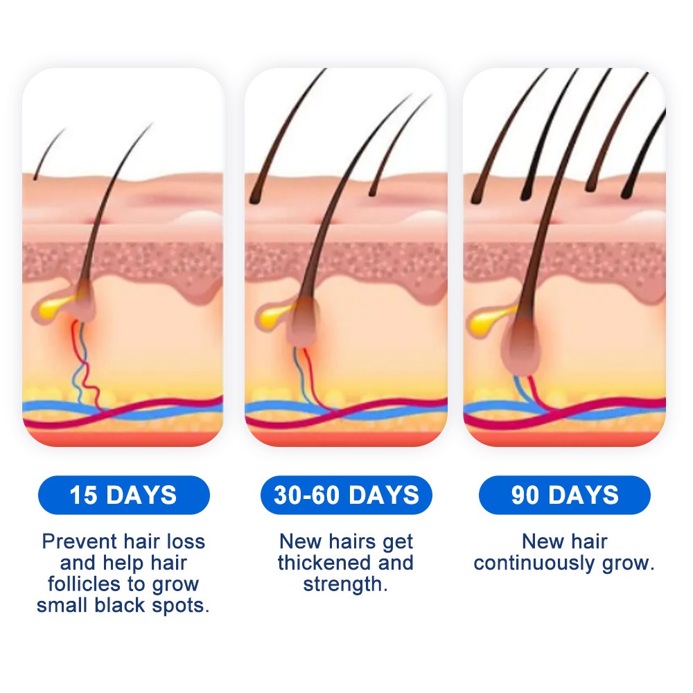 Alopesi Saç Çıkarma Spreyi Sop - Hair Care Cream incelemesi ve fiyatı