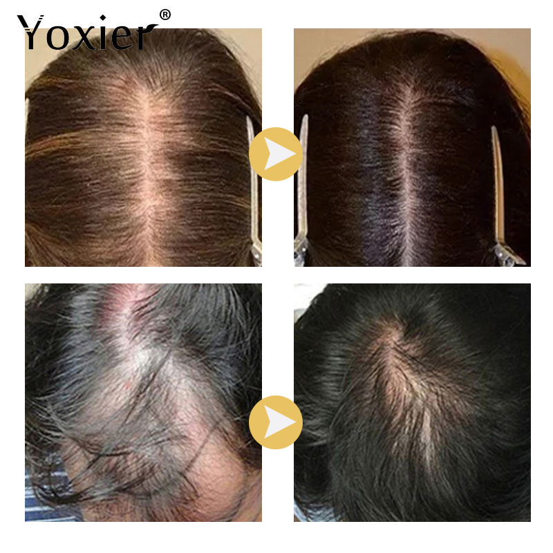 Yoğun büyüme serumu önlemek sa - Hair Care Treatment incelemesi ve fiyatı