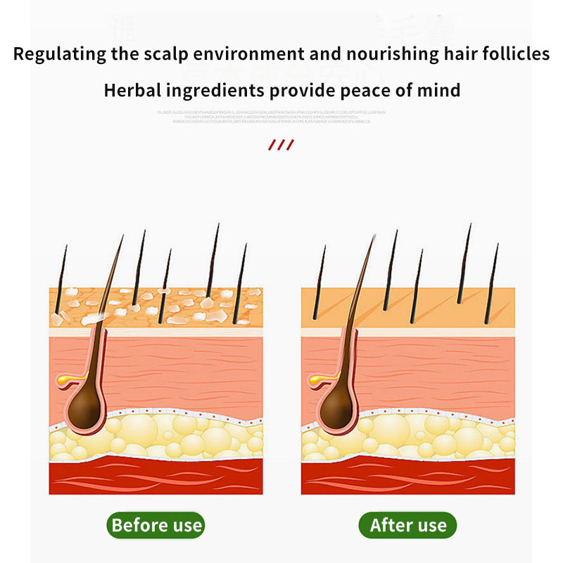 Sophora Flavescens Saç Folikül - Hair Care Cream incelemesi ve fiyatı